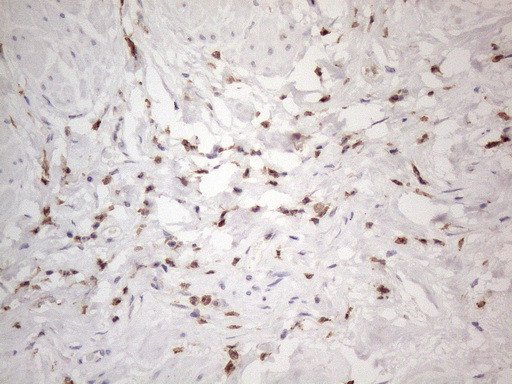 SNRPB2 Antibody in Immunohistochemistry (Paraffin) (IHC (P))