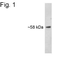 SNTB2 Antibody in Western Blot (WB)