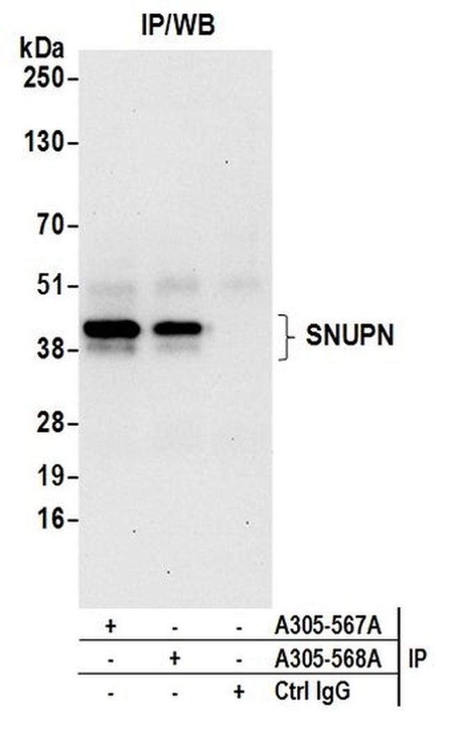 SNUPN Antibody in Western Blot (WB)
