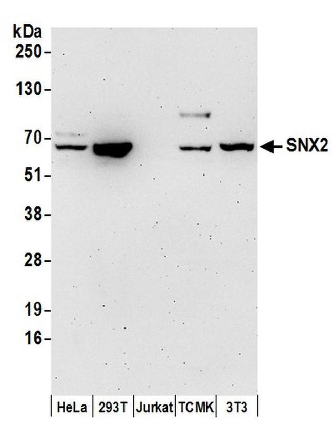 SNX2 Antibody in Western Blot (WB)