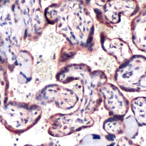 SOCS6 Antibody in Immunohistochemistry (IHC)