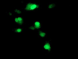 SOCS3 Antibody in Immunocytochemistry (ICC/IF)