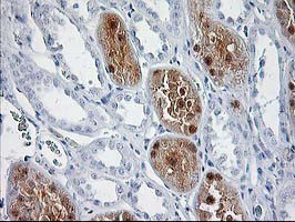 SOCS3 Antibody in Immunohistochemistry (Paraffin) (IHC (P))