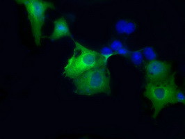 SORD Antibody in Immunocytochemistry (ICC/IF)