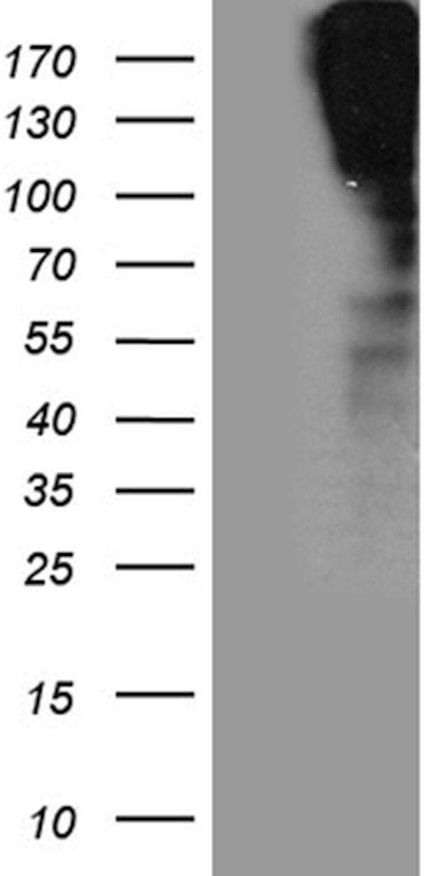 SORL1 Antibody in Western Blot (WB)