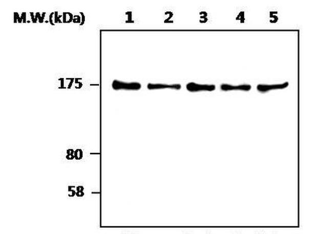 SOS1 Antibody in Western Blot (WB)