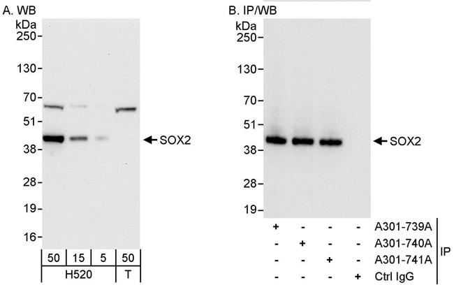 SOX2 Antibody in Western Blot (WB)