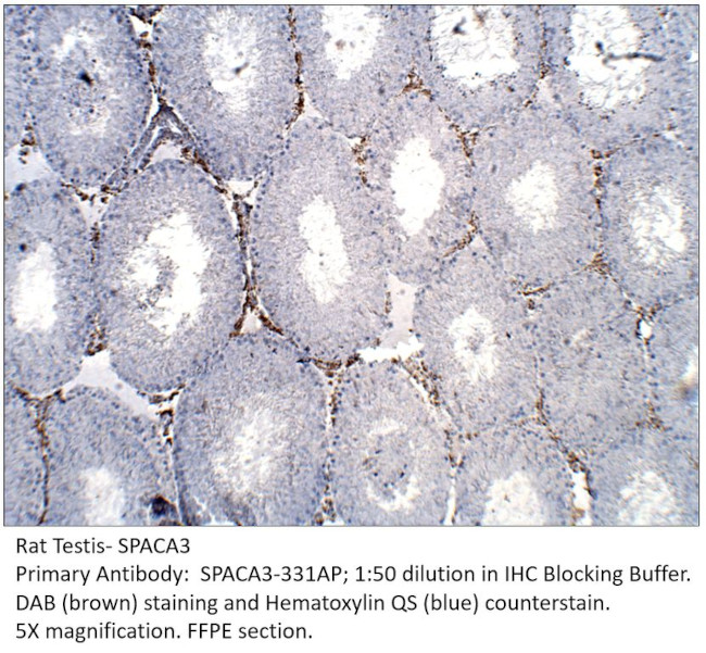 SPACA3 Antibody in Immunohistochemistry (IHC)