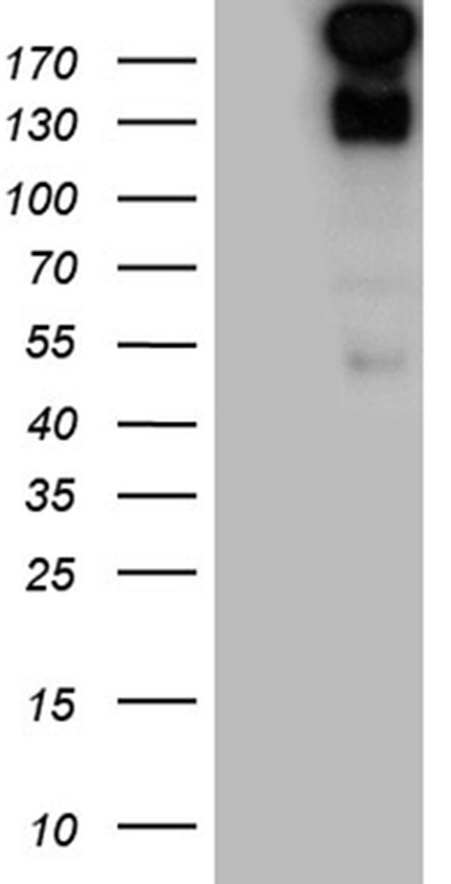 SPAG5 Antibody in Western Blot (WB)