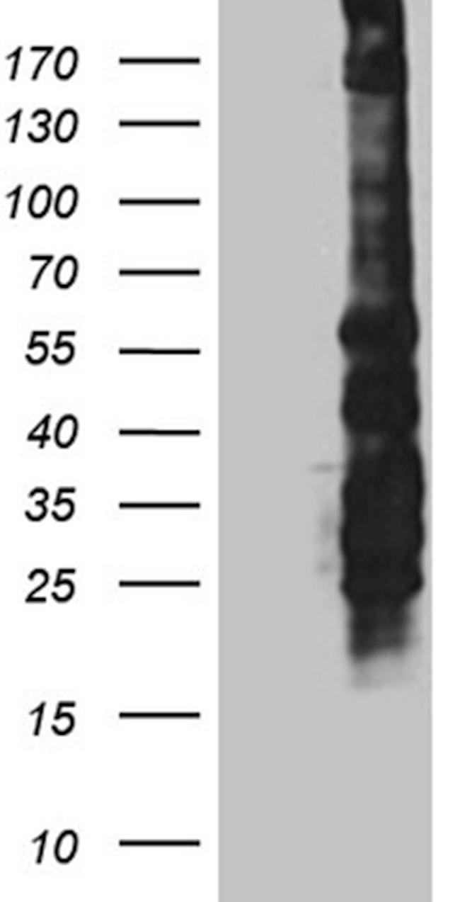 SPAG5 Antibody in Western Blot (WB)