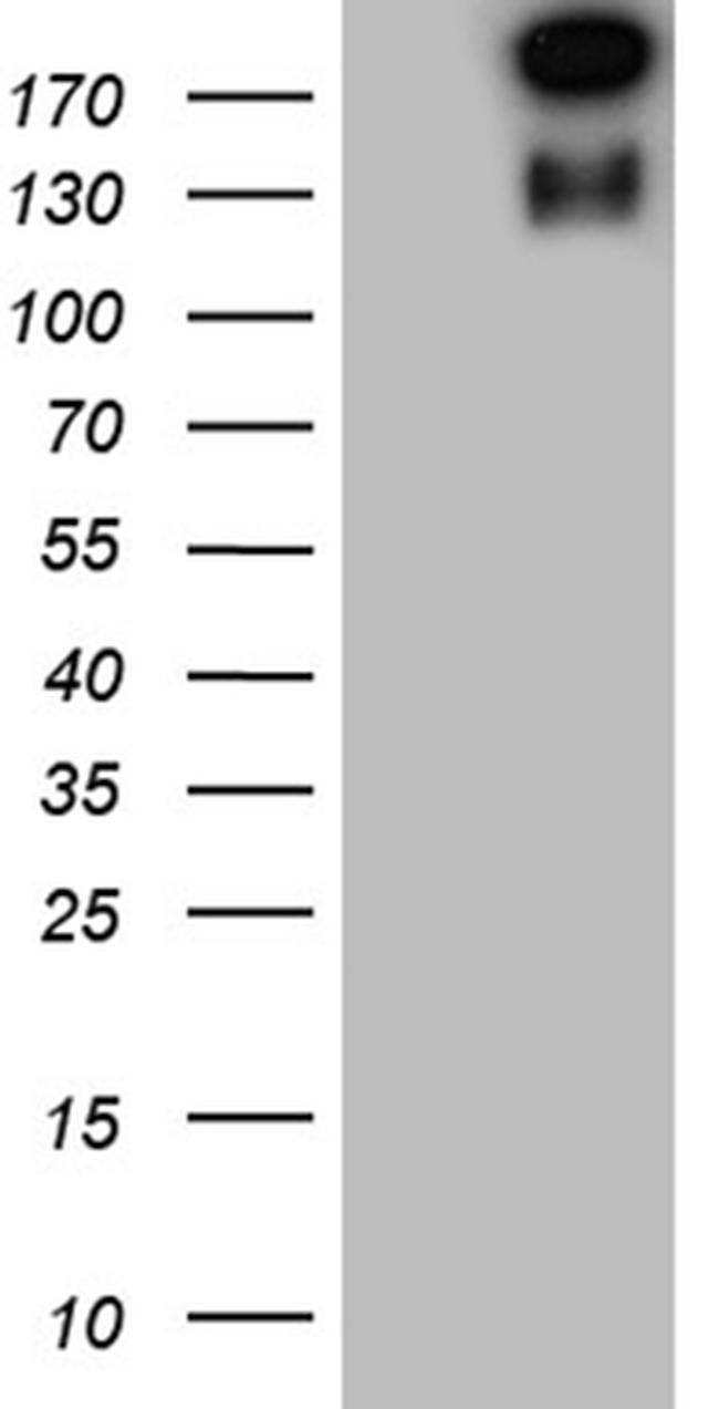 SPAG5 Antibody in Western Blot (WB)