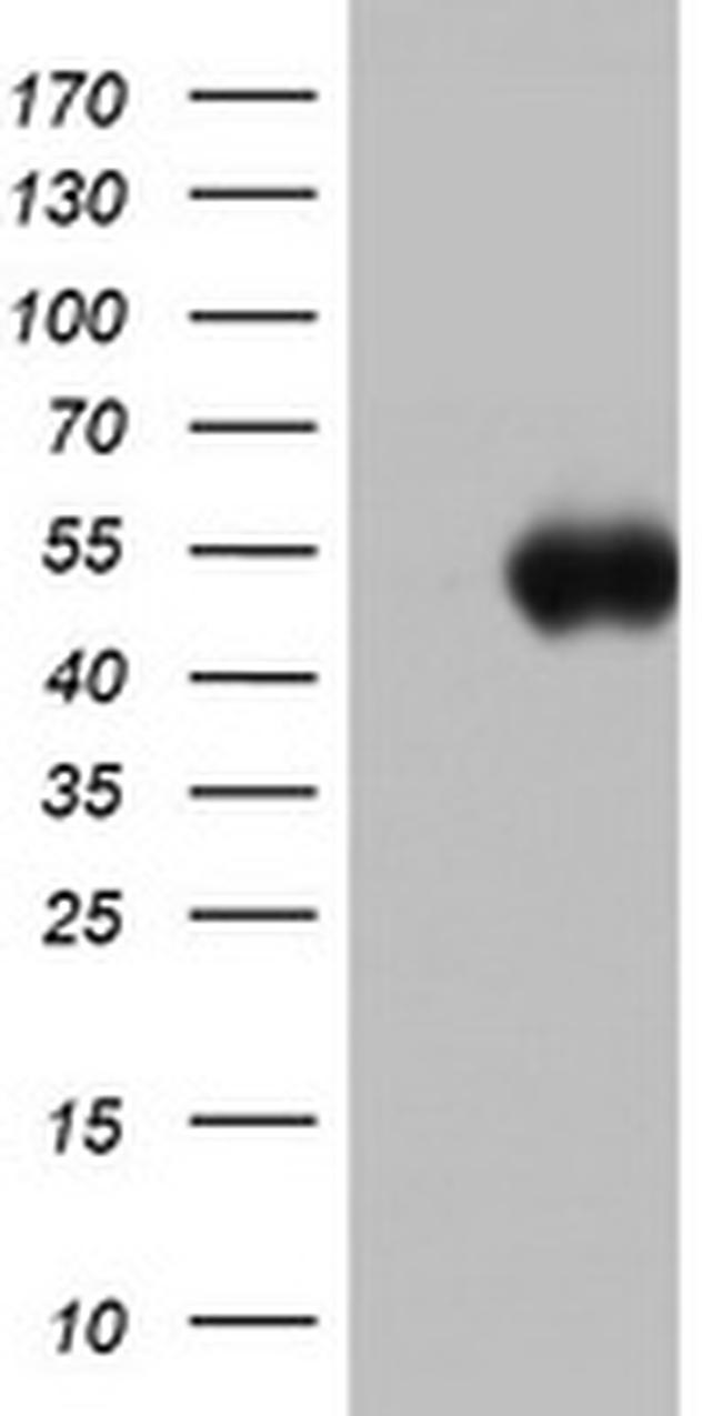 SPATA2L Antibody in Western Blot (WB)