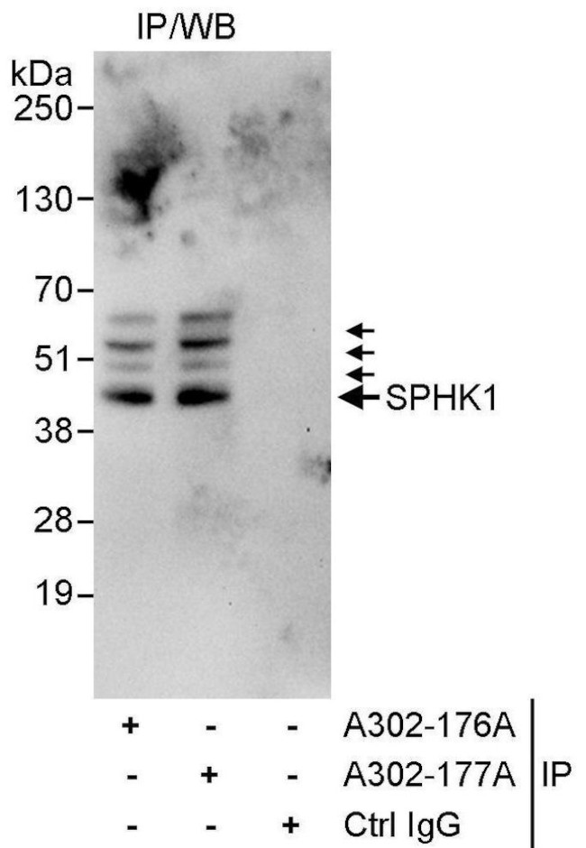 SPHK1 Antibody in Immunoprecipitation (IP)