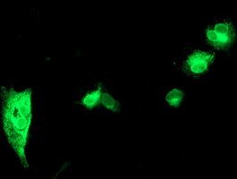 SPINT1 Antibody in Immunocytochemistry (ICC/IF)