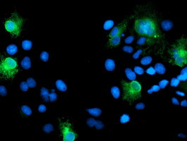 SPINT1 Antibody in Immunocytochemistry (ICC/IF)