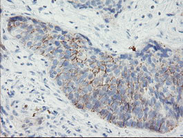 SPINT1 Antibody in Immunohistochemistry (Paraffin) (IHC (P))