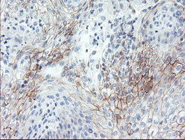 SPINT1 Antibody in Immunohistochemistry (Paraffin) (IHC (P))