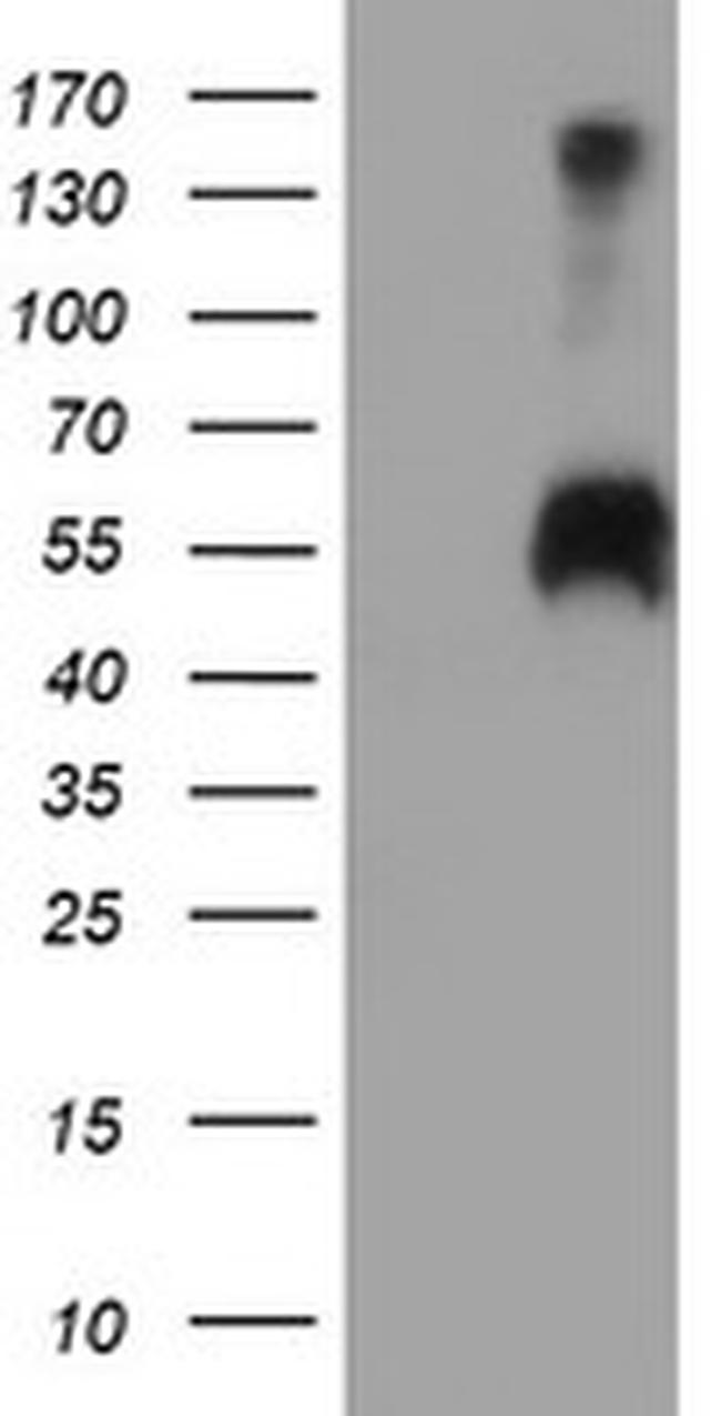 SPINT1 Antibody in Western Blot (WB)