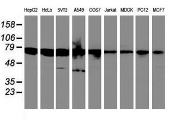 SPINT1 Antibody in Western Blot (WB)