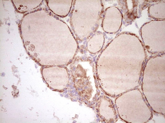 SPP1 Antibody in Immunohistochemistry (Paraffin) (IHC (P))