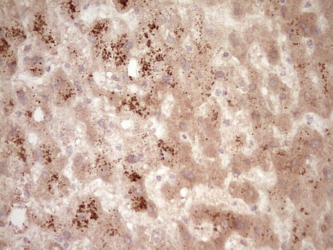 SPP1 Antibody in Immunohistochemistry (Paraffin) (IHC (P))