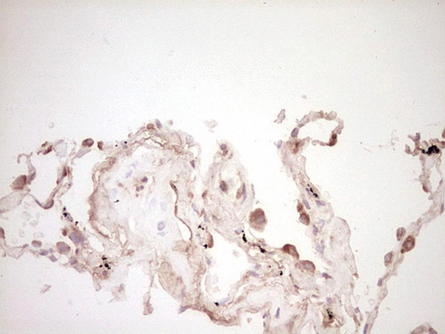 SPP1 Antibody in Immunohistochemistry (Paraffin) (IHC (P))