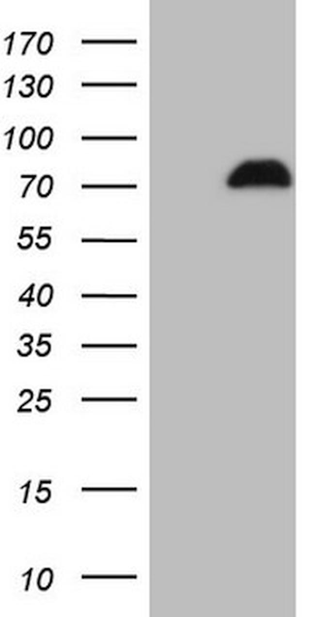 SPP1 Antibody in Western Blot (WB)