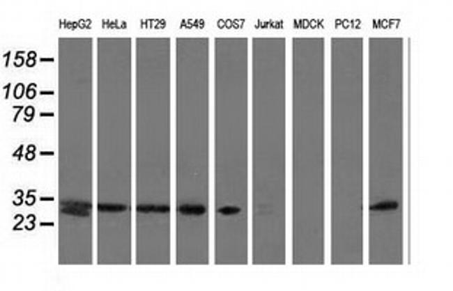 SPR Antibody in Western Blot (WB)