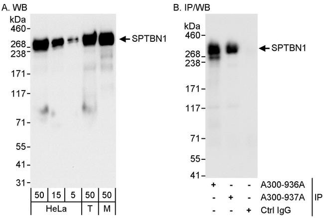 SPTBN1 Antibody in Western Blot (WB)