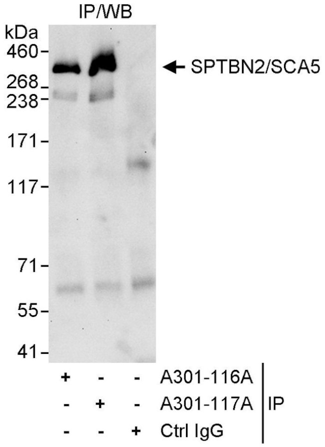 SPTBN2/SCA5 Antibody in Immunoprecipitation (IP)