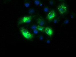 SQSTM1 Antibody in Immunocytochemistry (ICC/IF)