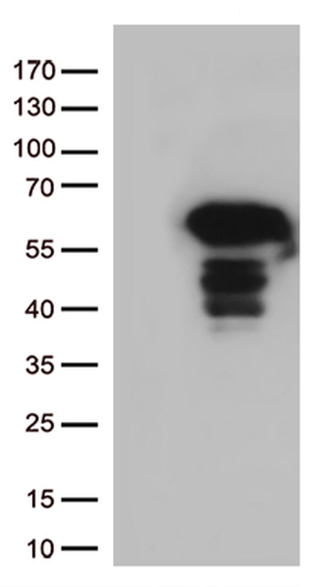 SQSTM1 Antibody in Western Blot (WB)