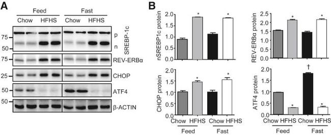 SREBP1 Antibody in Western Blot (WB)