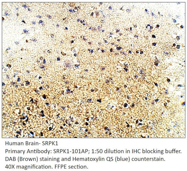 SRPK1 Antibody in Immunohistochemistry (IHC)