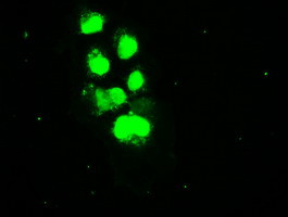 SSB Antibody in Immunocytochemistry (ICC/IF)