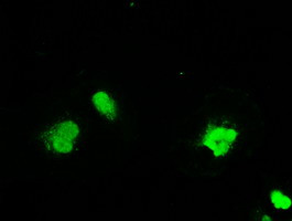 SSB Antibody in Immunocytochemistry (ICC/IF)