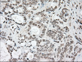 SSB Antibody in Immunohistochemistry (Paraffin) (IHC (P))