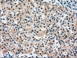 SSB Antibody in Immunohistochemistry (Paraffin) (IHC (P))