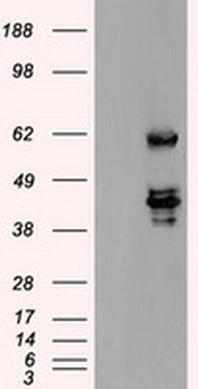 SSB Antibody in Western Blot (WB)