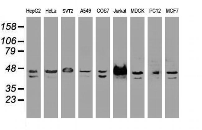 SSB Antibody in Western Blot (WB)