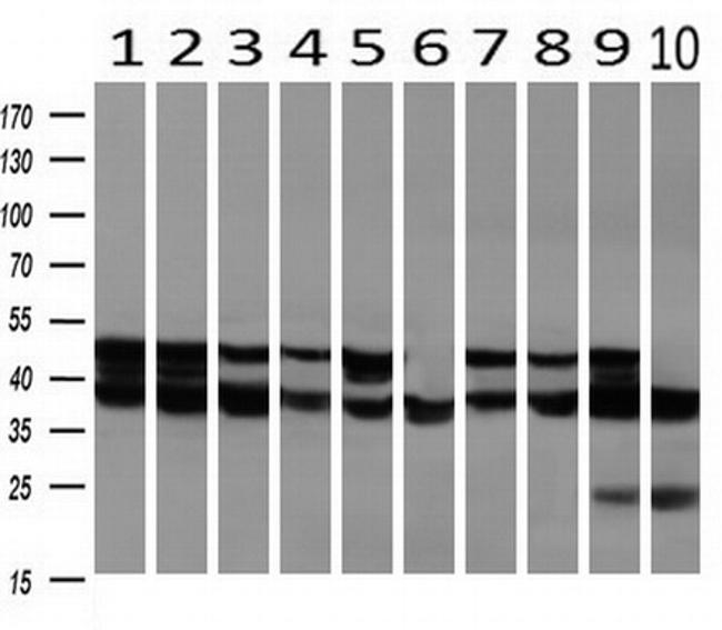 SSB Antibody in Western Blot (WB)