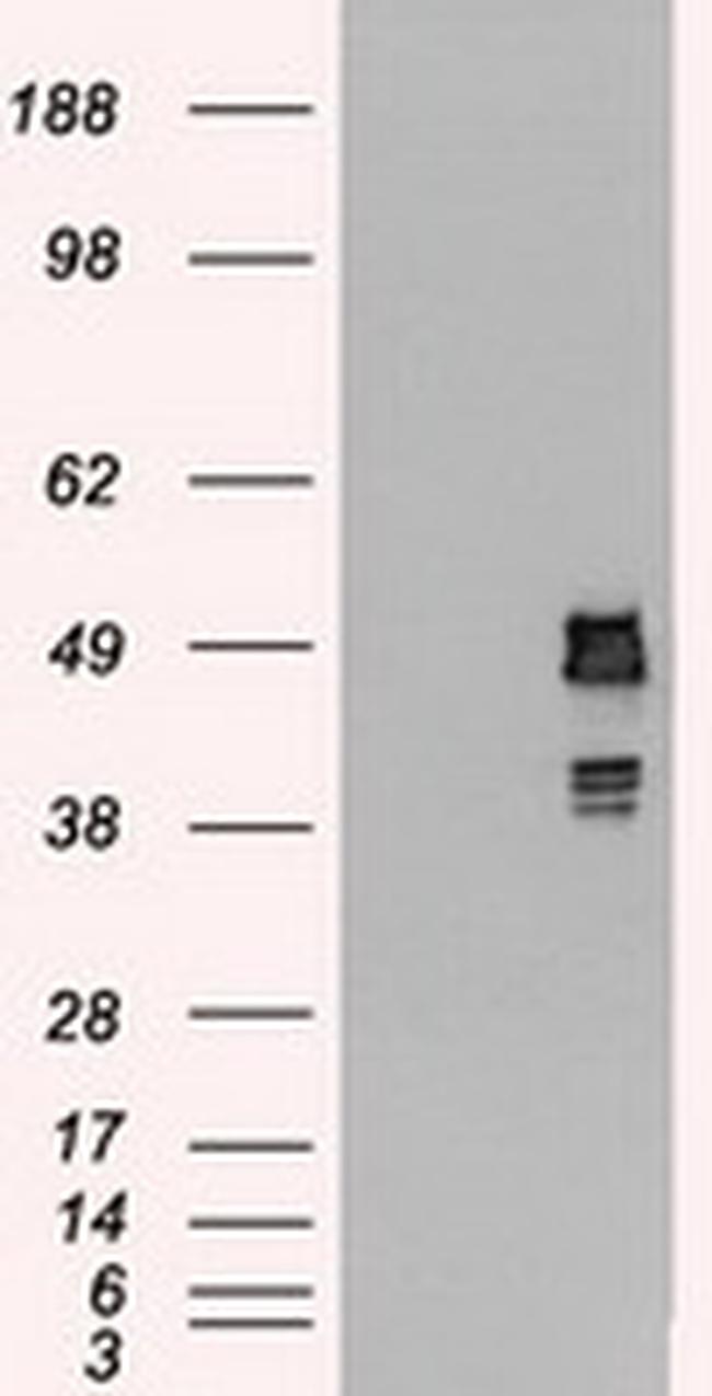 SSB Antibody in Western Blot (WB)