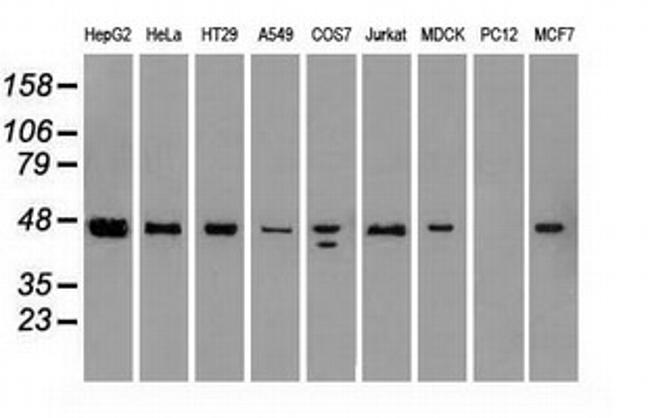 SSB Antibody in Western Blot (WB)