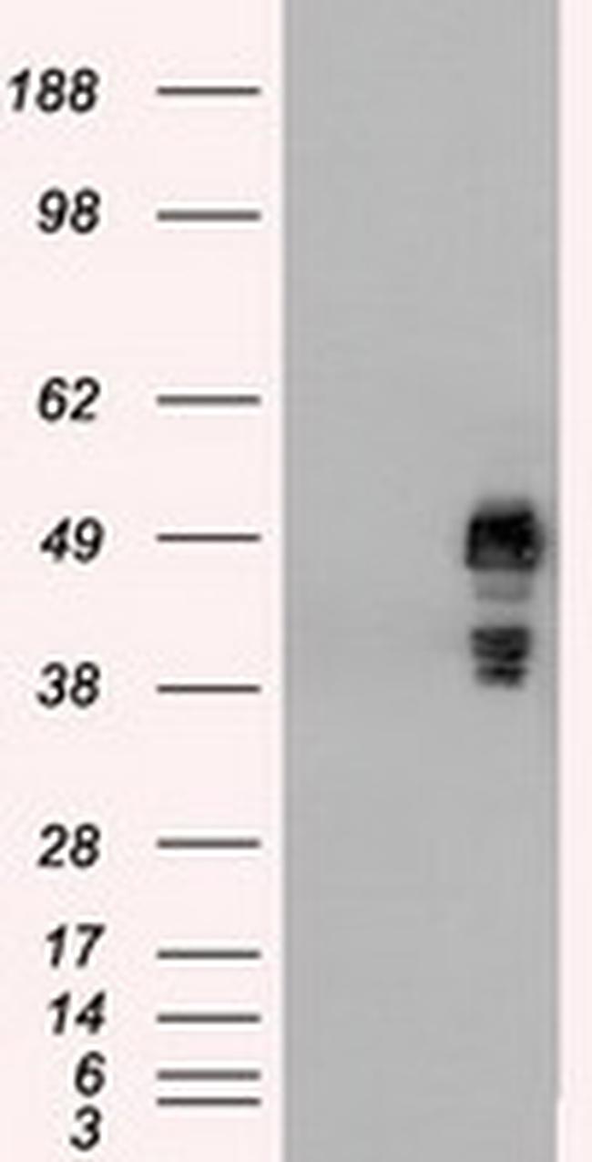 SSB Antibody in Western Blot (WB)