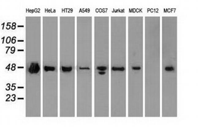 SSB Antibody in Western Blot (WB)