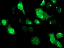 SSR1 Antibody in Immunocytochemistry (ICC/IF)