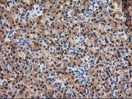 SSR1 Antibody in Immunohistochemistry (Paraffin) (IHC (P))