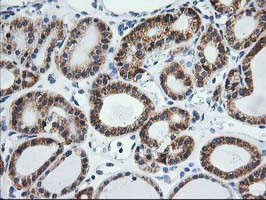 SSR1 Antibody in Immunohistochemistry (Paraffin) (IHC (P))