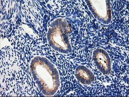 SSR1 Antibody in Immunohistochemistry (Paraffin) (IHC (P))