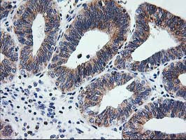 SSR1 Antibody in Immunohistochemistry (Paraffin) (IHC (P))